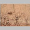 Neuronas Golgi 06.jpg